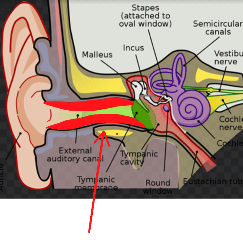 ear pain