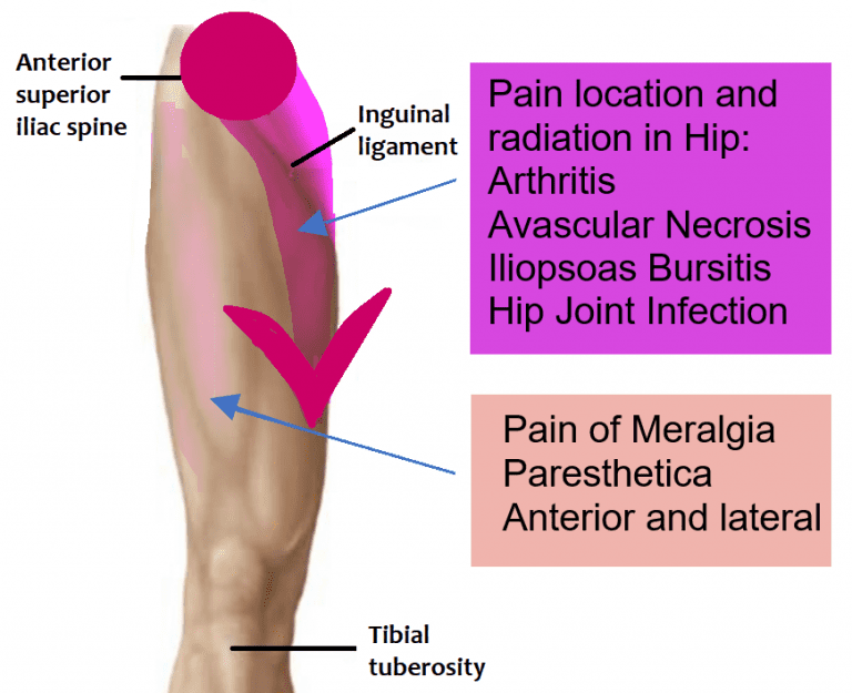 Hip Pain​ - Medical Care One